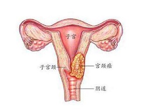 郑州看肿瘤有名的中医师