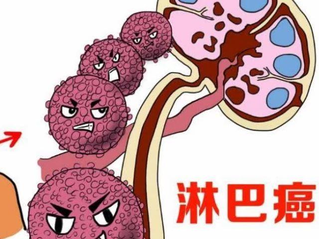 淋巴癌的危害是什么?赶紧看一下